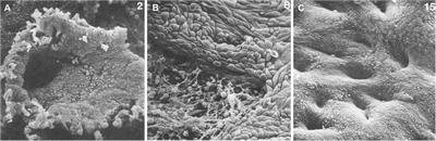 The Elusive Endometrial Epithelial Stem/Progenitor Cells